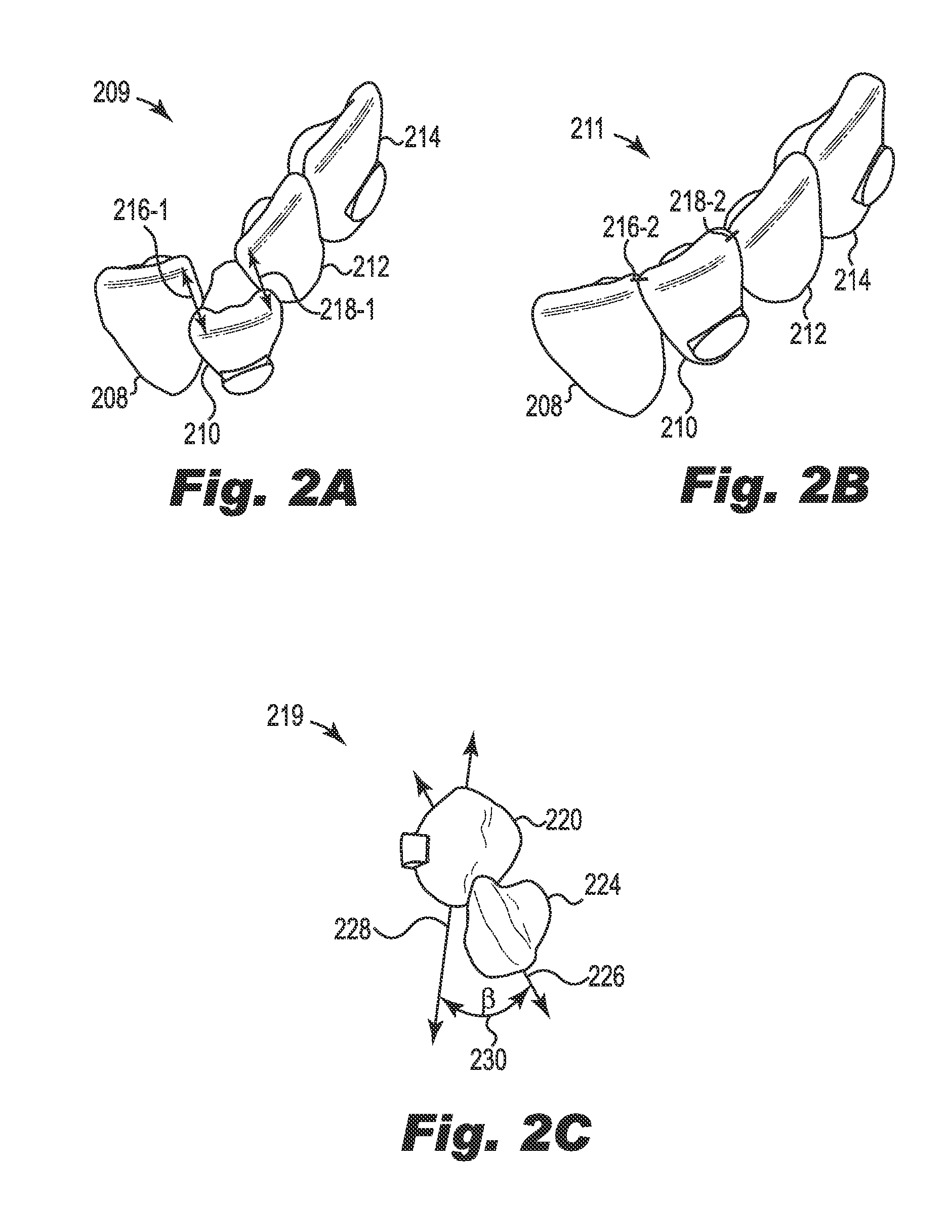 Interproximal reduction planning