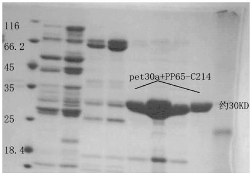 Hybridoma cell line c11-6f7 and its hcmv monoclonal antibody and application