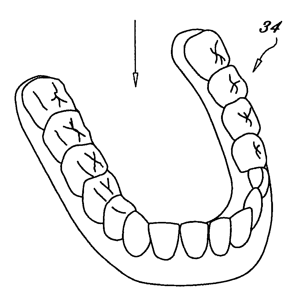 Orthodontic appliance with embedded wire for moving teeth and method