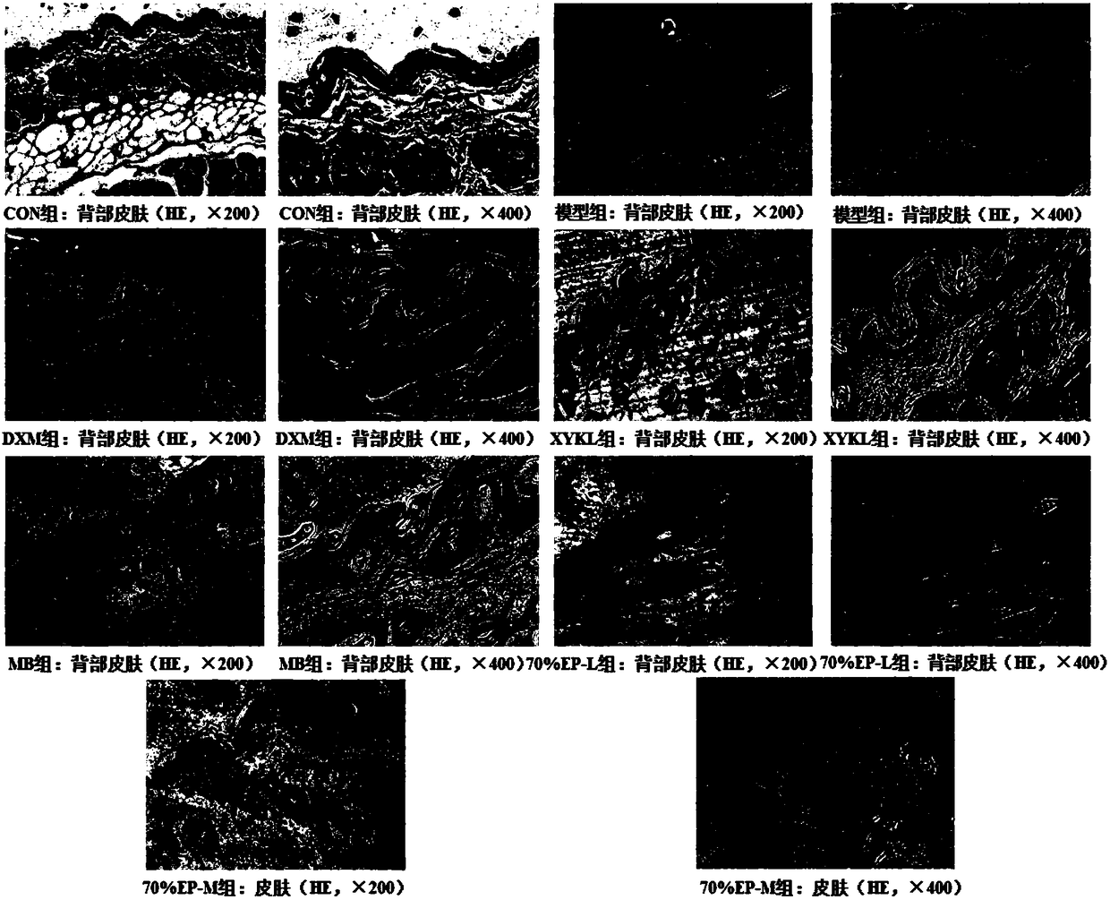 Application of rumex madaio makino to drugs for treating psoriasis