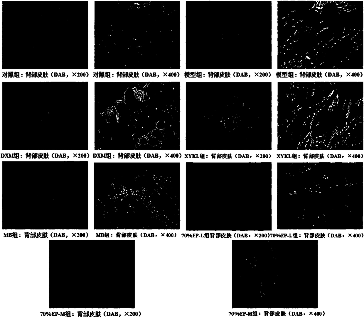 Application of rumex madaio makino to drugs for treating psoriasis