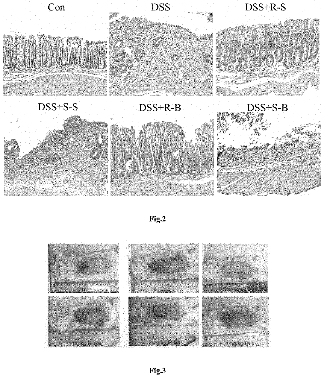 New use of R-enantiomer of adrenergic beta 2 receptor agonists for treatment of inflammatory bowel disease and its extra intestinal manifestations