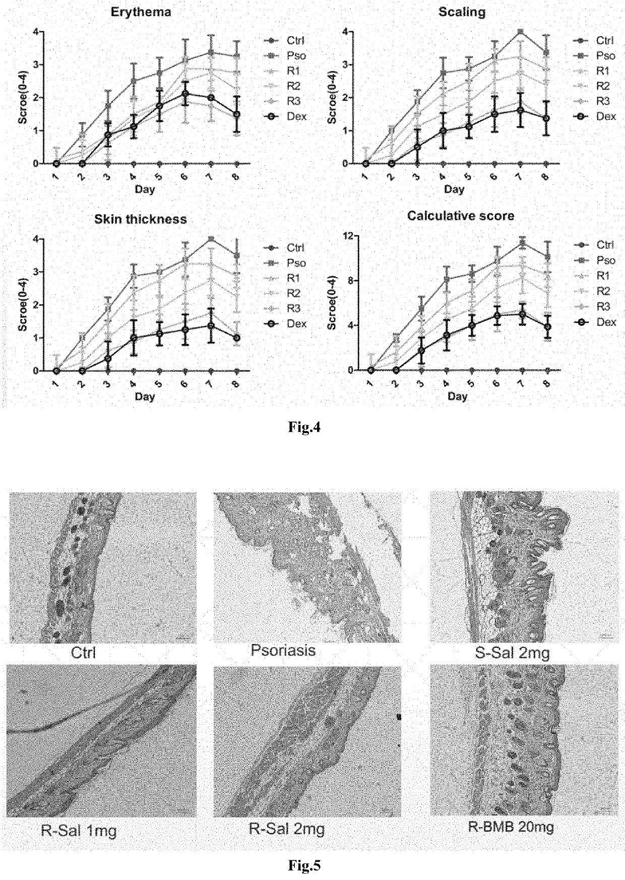 New use of R-enantiomer of adrenergic beta 2 receptor agonists for treatment of inflammatory bowel disease and its extra intestinal manifestations