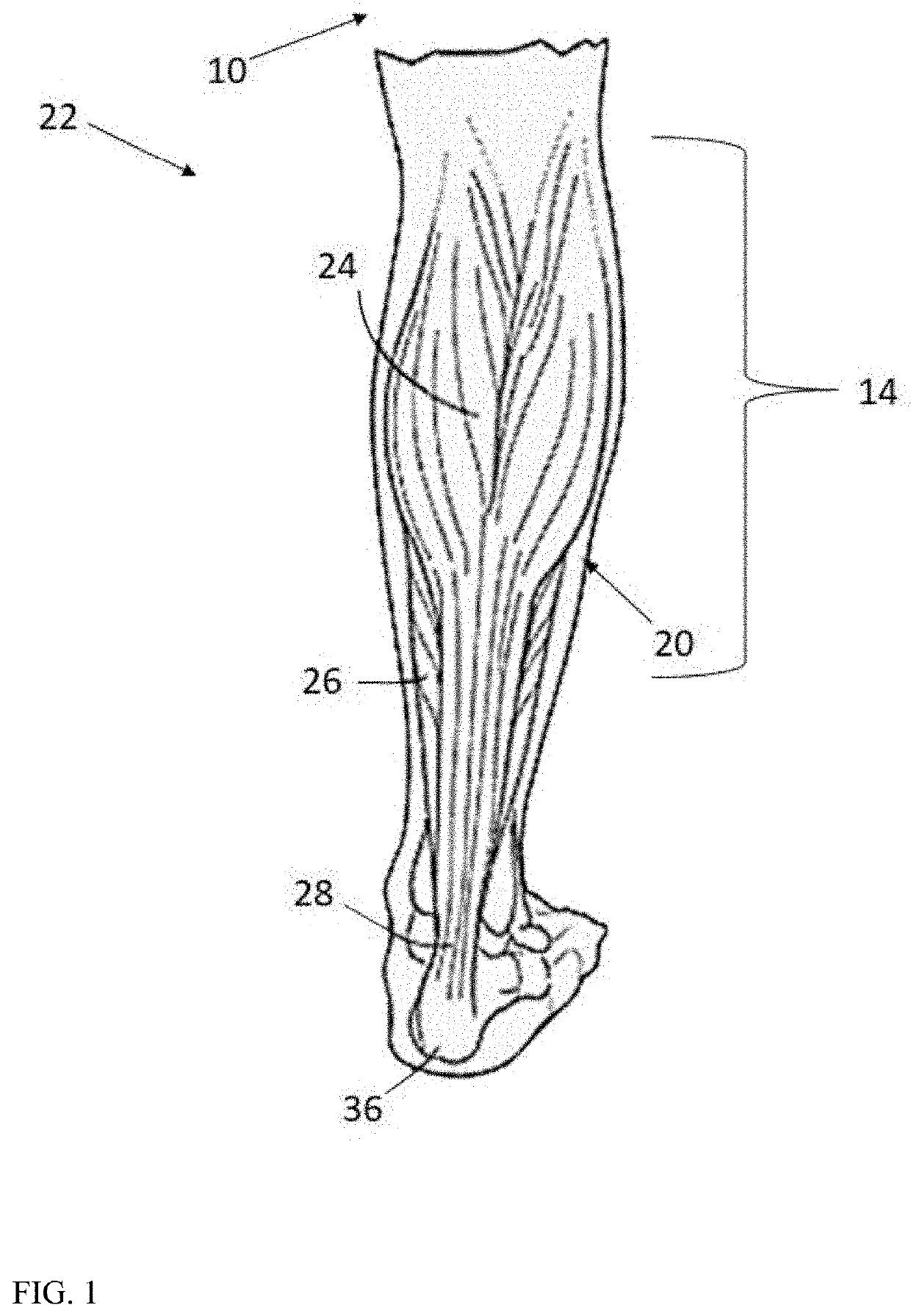 Dorsiflexion/plantarflexion extension above the knee brace