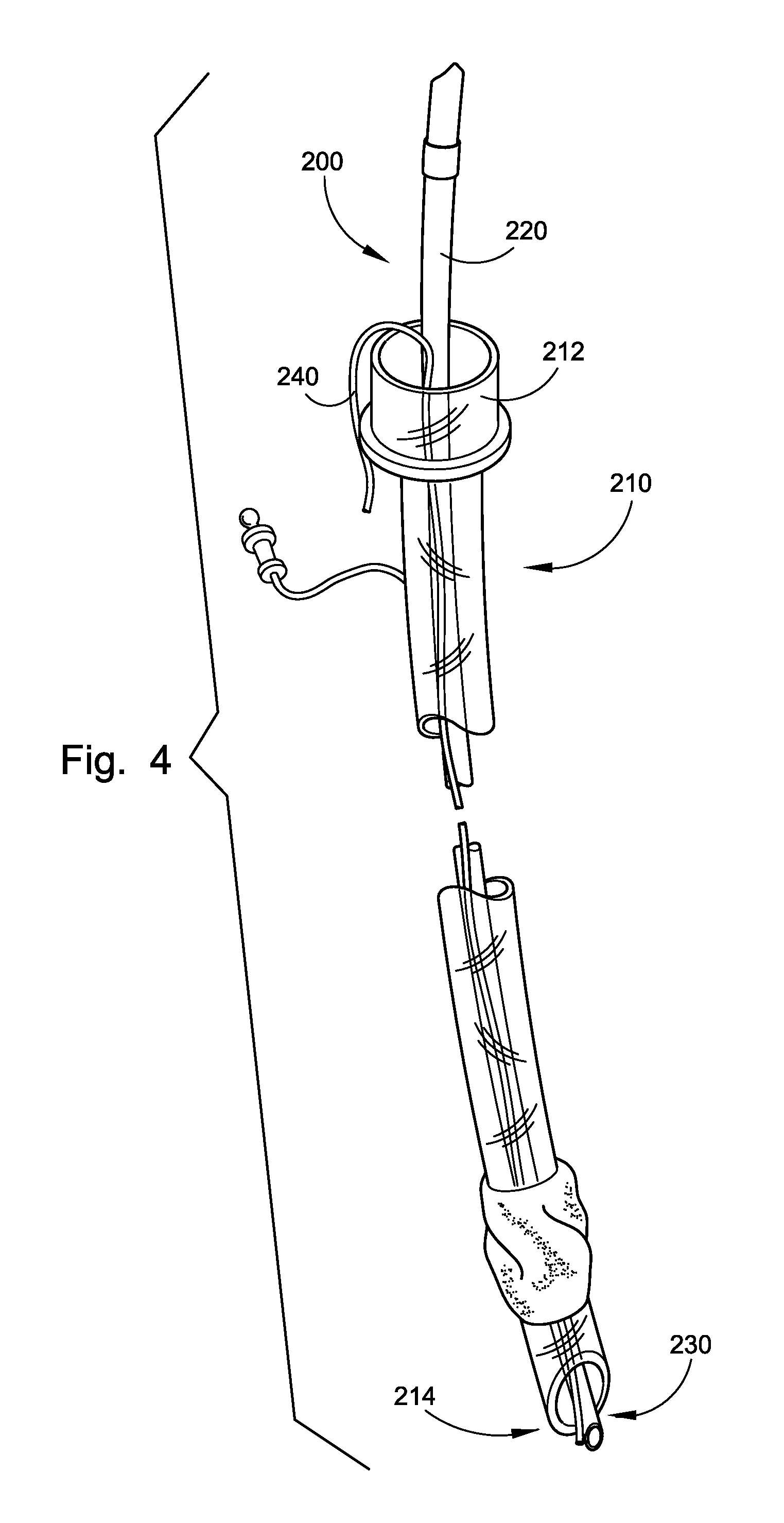 Laryngoscope and Method of Use