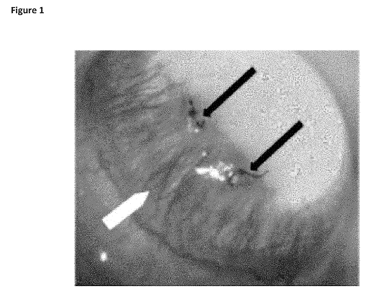 Treatment of ocular disease