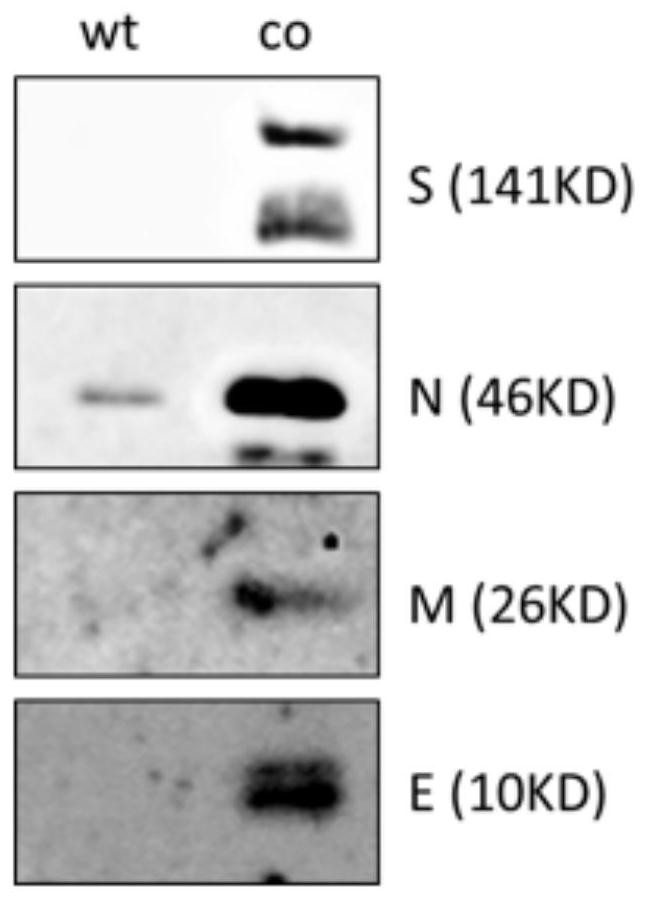 Nucleic acid molecule encoding structural protein of novel coronavirus and novel coronavirus vaccine