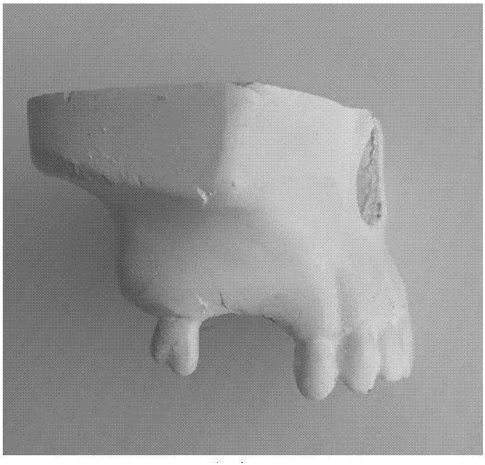 Manufacturing method for dental implant assembly