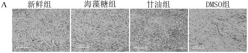 Cryoprotectant free of DMSO (dimethyl sulfoxide) and ovary cryopreservation method