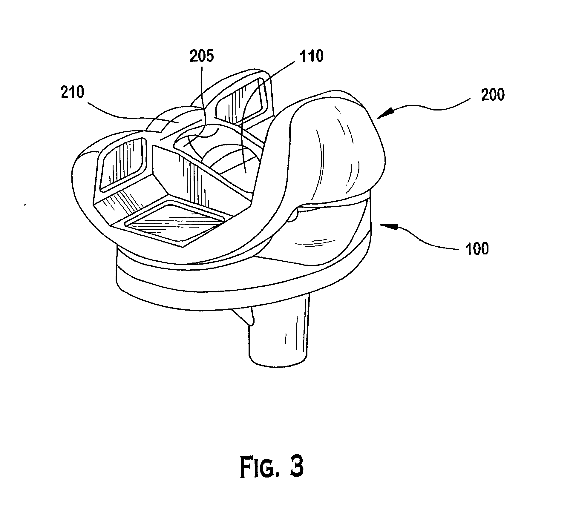 Knee prosthesis