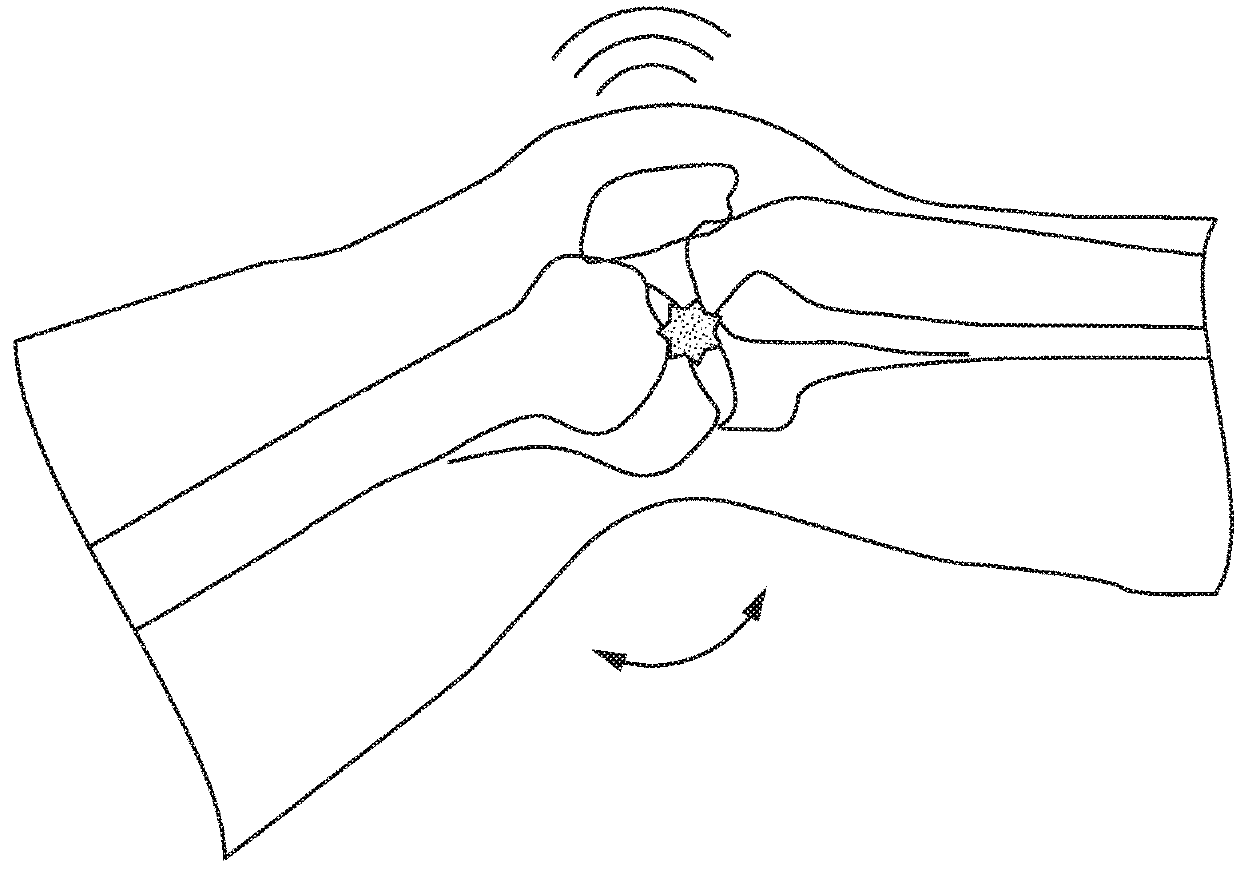 Wearable Technologies For Joint Health Assessment