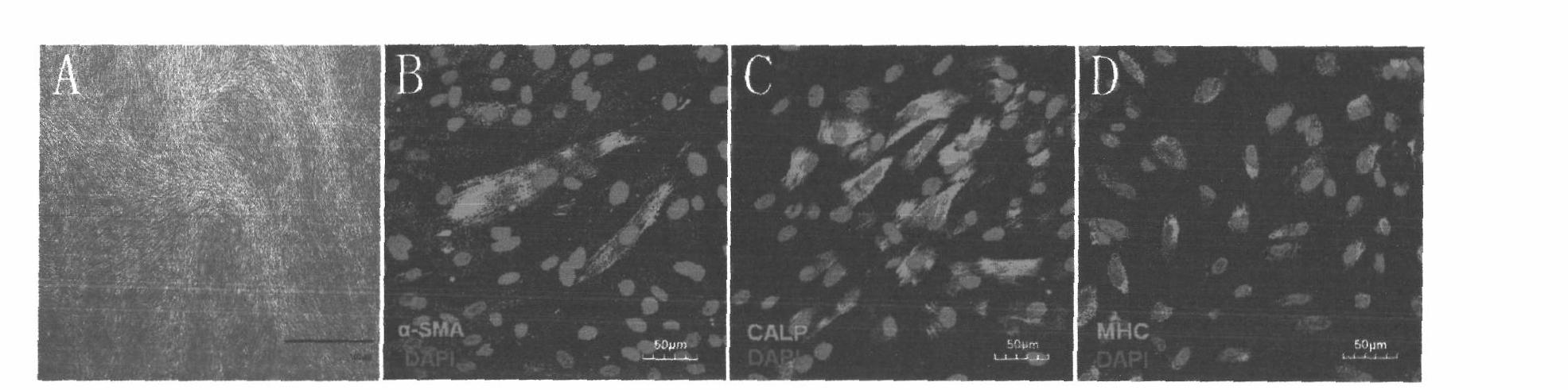 New born child tissue engineering bladder piece and preparation method thereof