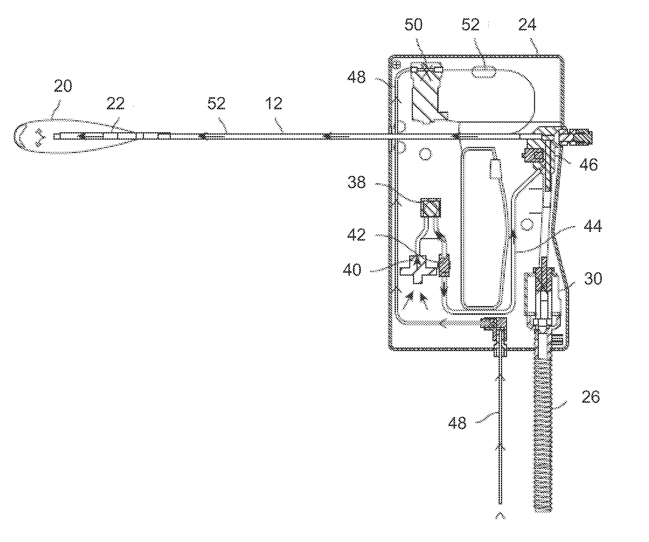 Apparatus and methods for regulating cryogenic treatment