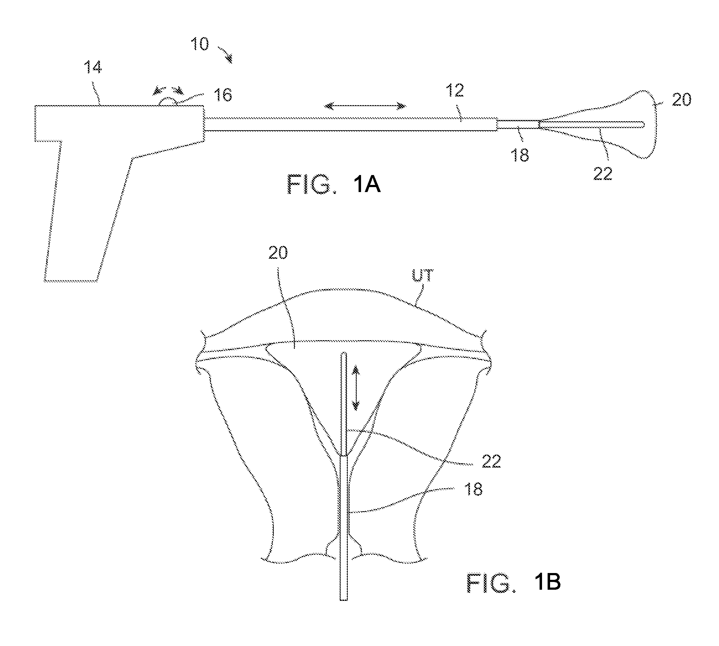 Apparatus and methods for regulating cryogenic treatment