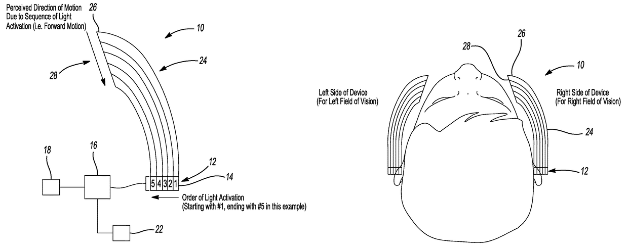 Universal motion sickness countermeasure system