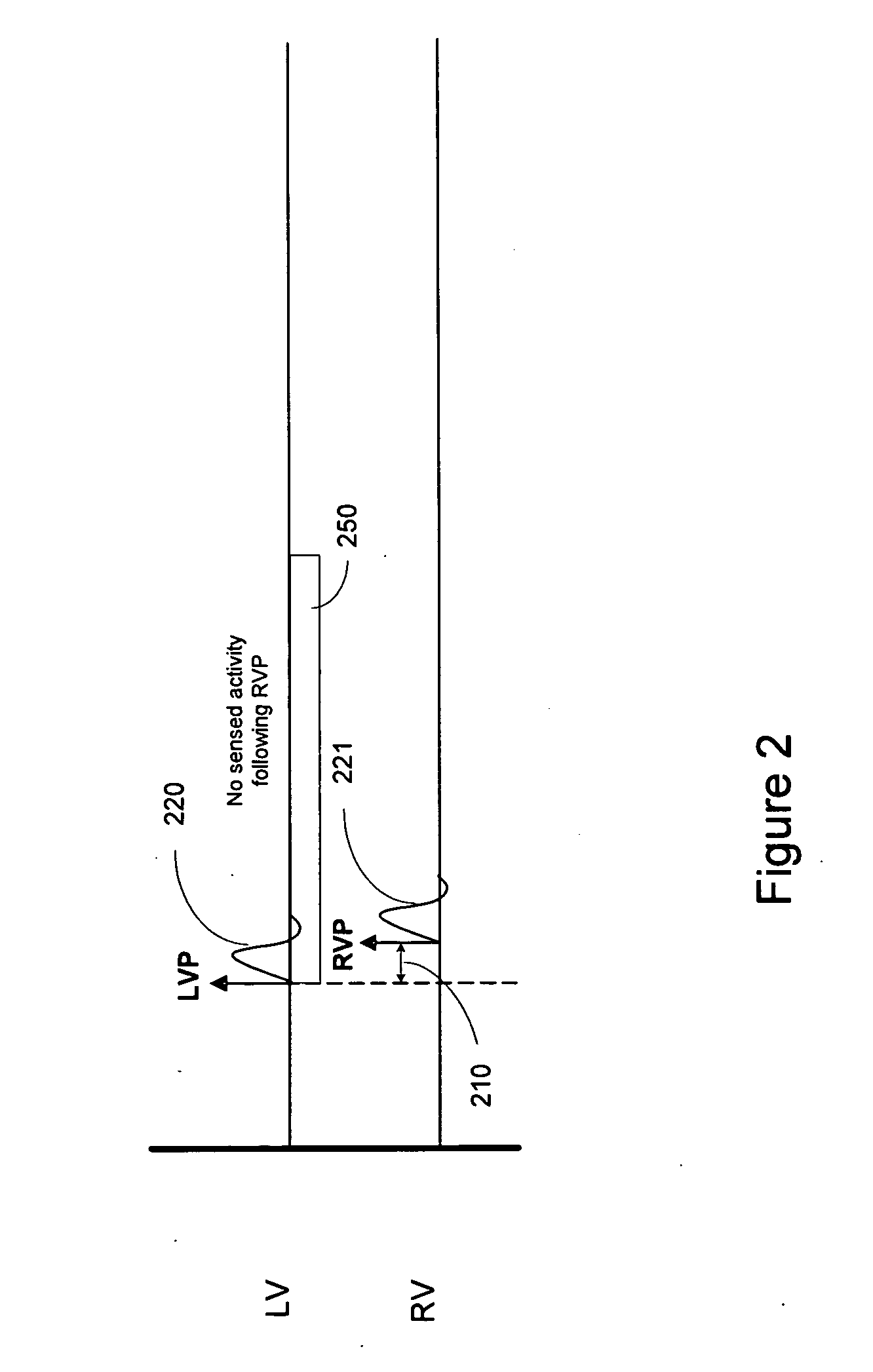 Capture detection based on propagated depolarization from a remote pacing site