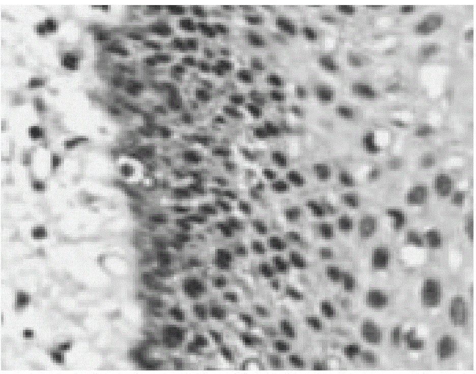 Double-dyeing kit for cervical intraepithelial neoplasia grading assisted diagnosis, and applications thereof