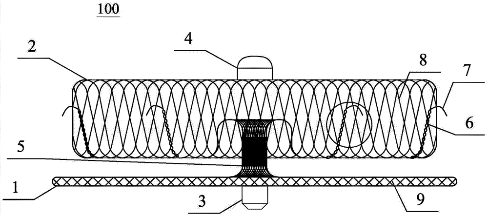 Left atrial appendage closure system