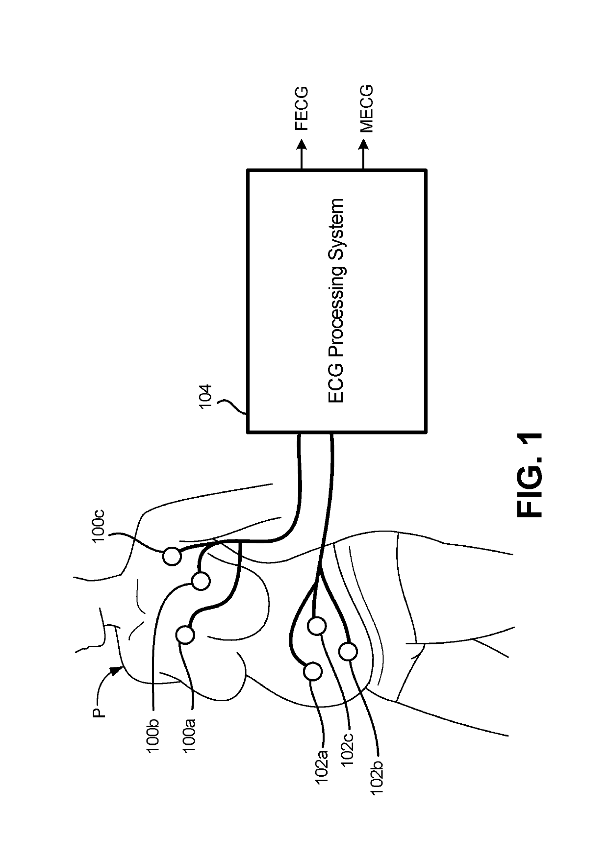 System and method for non-invasive extraction of fetal electrocardiogram signals