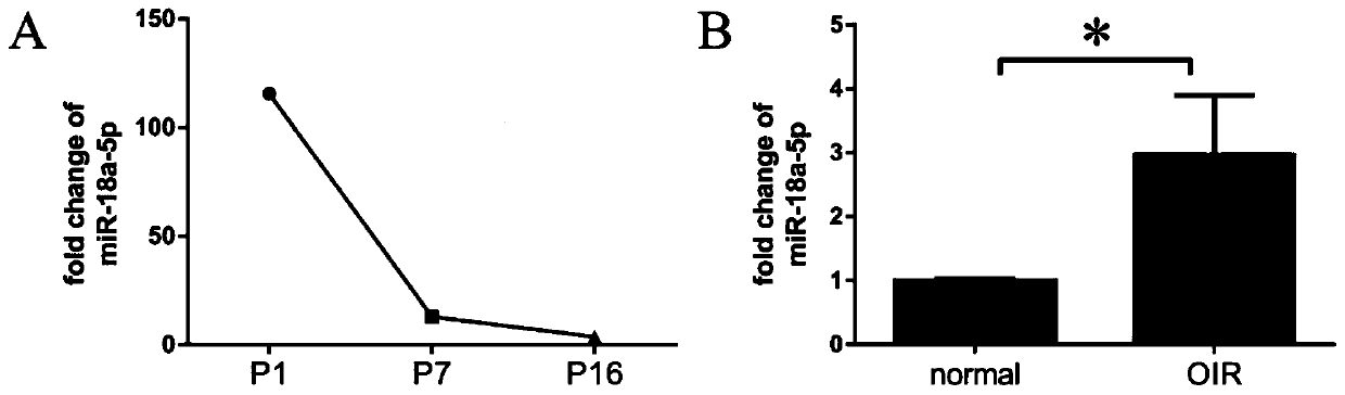 Application of miR-18a-5p agonist in preparing anti-retinal neovascularization drugs