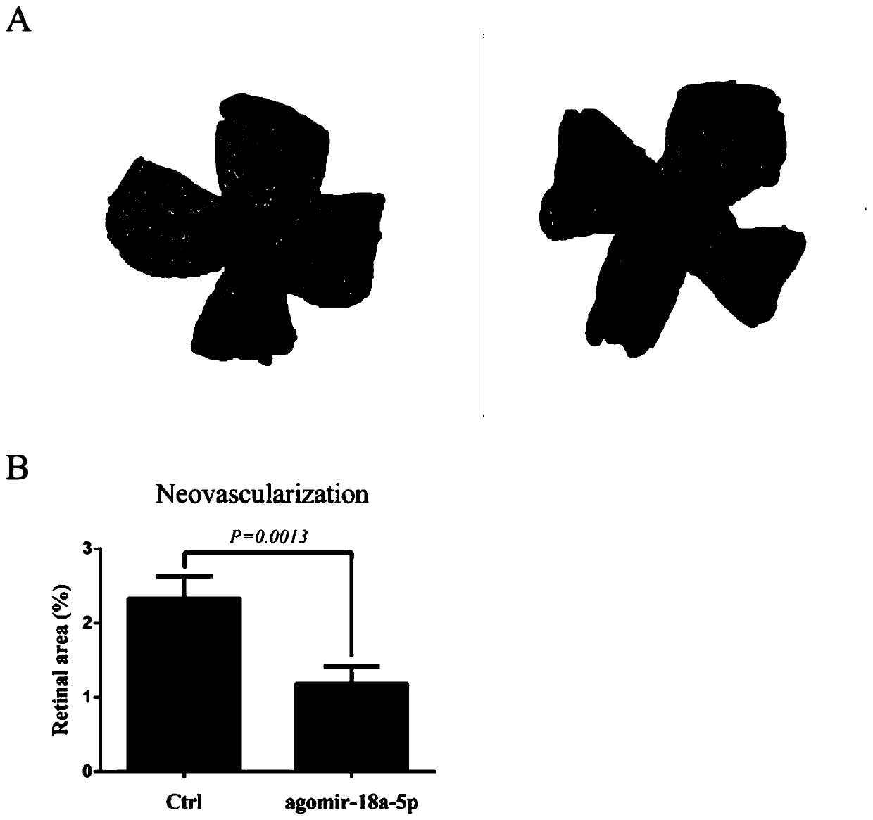 Application of miR-18a-5p agonist in preparing anti-retinal neovascularization drugs