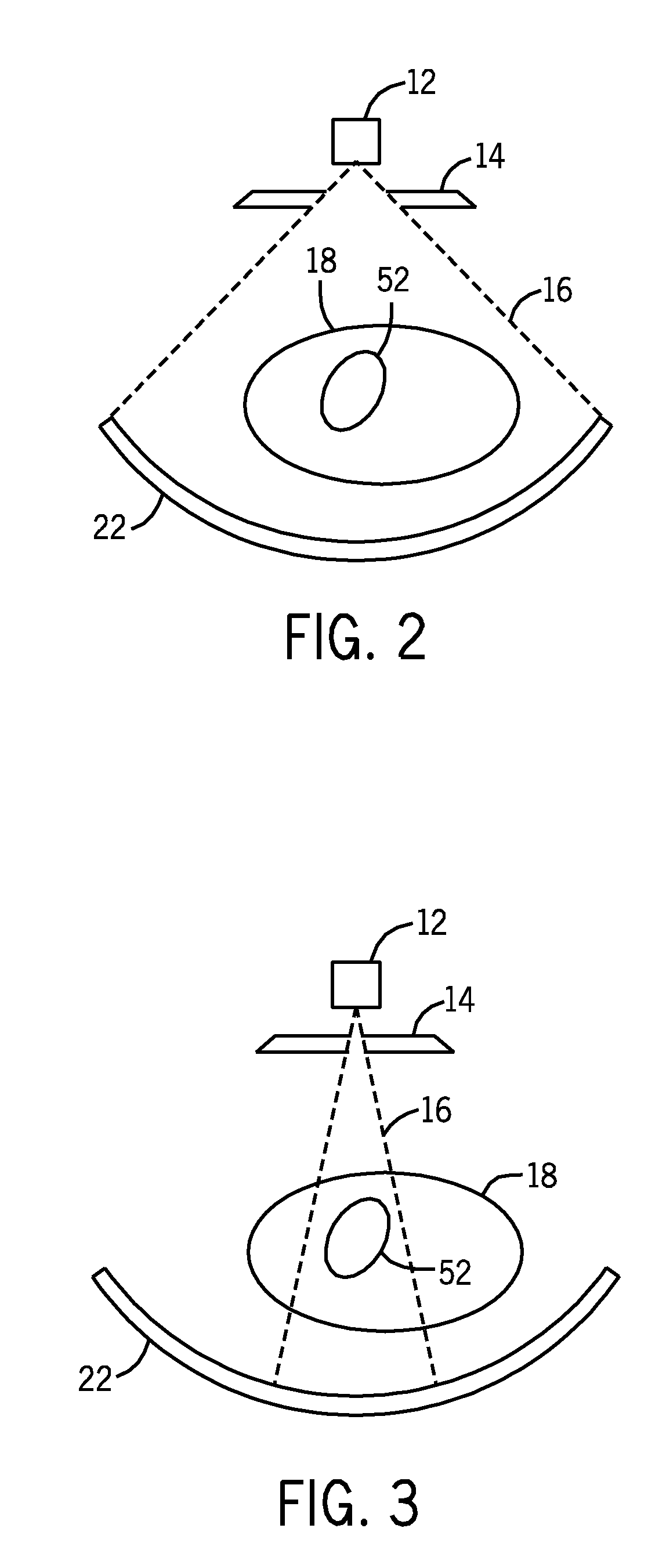 Keyhole computed tomography