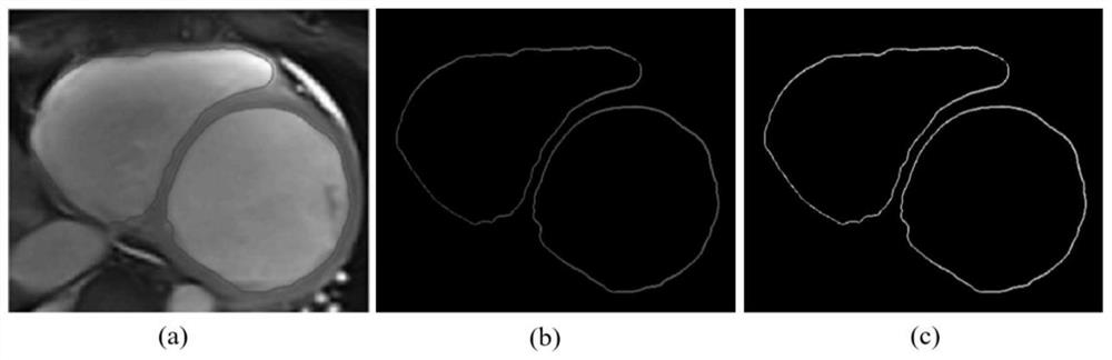 Automatic diagnosis system for human body dilated cardiomyopathy