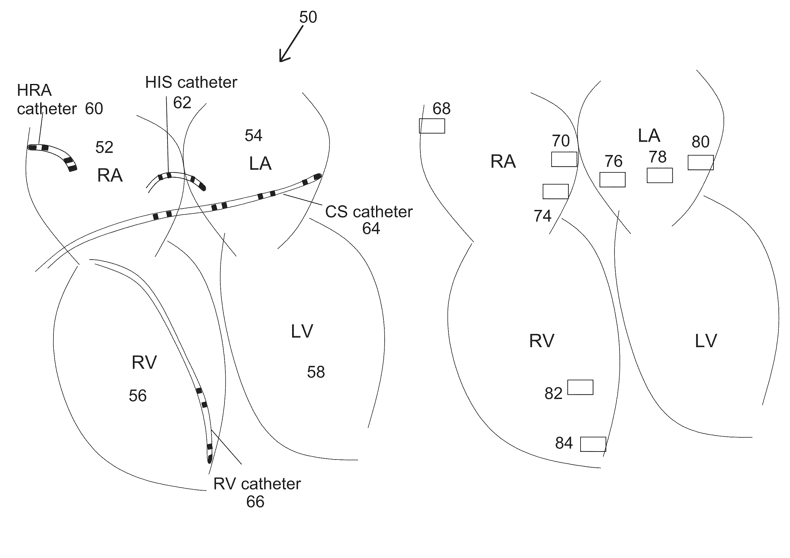 Methods and system for real-time cardiac mapping