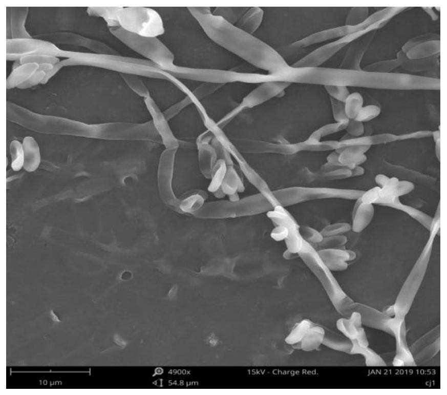 An anthocyanin producing strain cj6 and its application