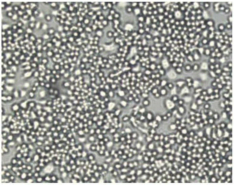 Production method for recombinant human fibroblast growth factor-18 and application of growth factor-18