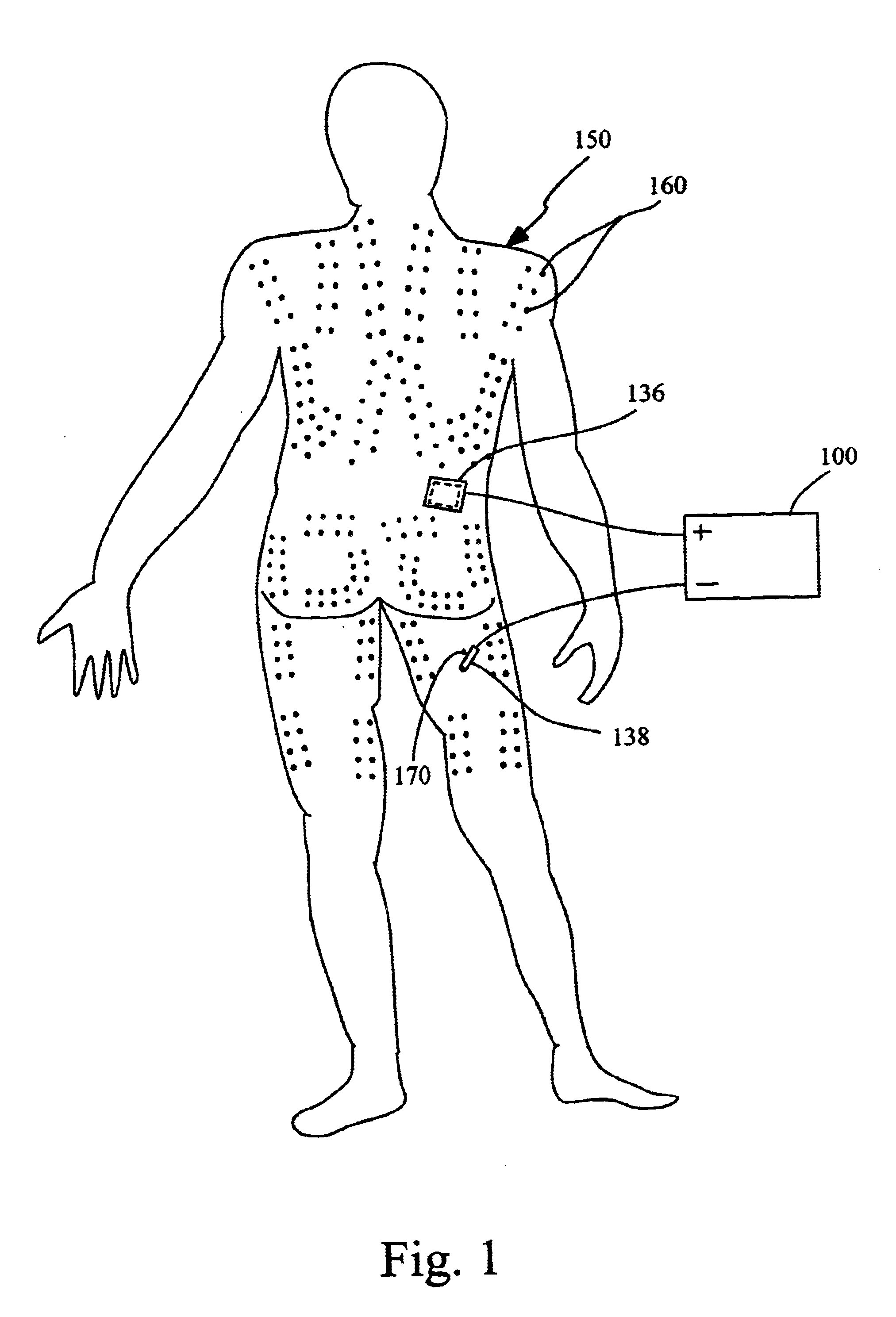 Method and device for electrochemically building of muscle