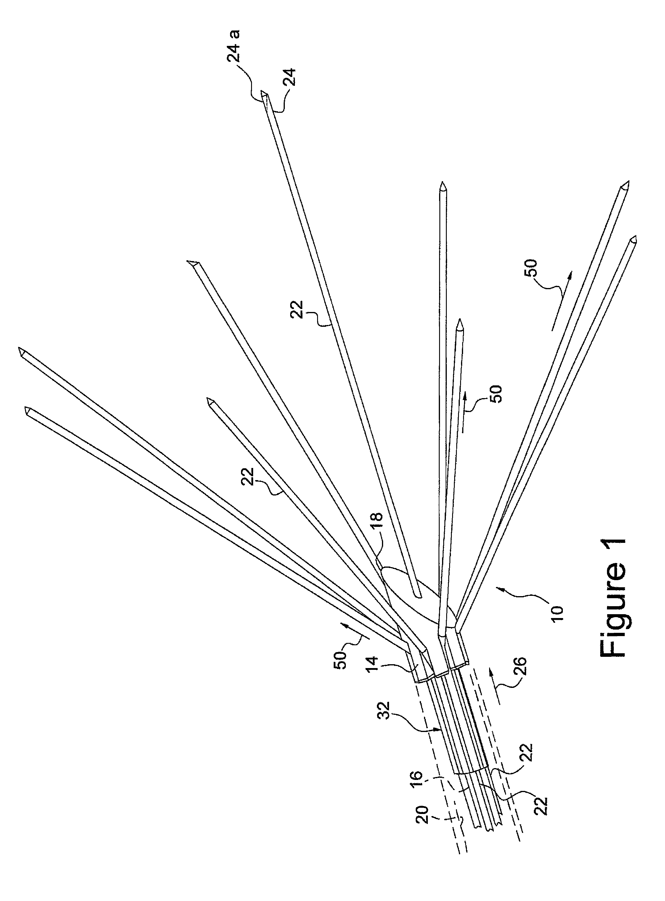 Radio frequency ablation device for the destruction of tissue masses