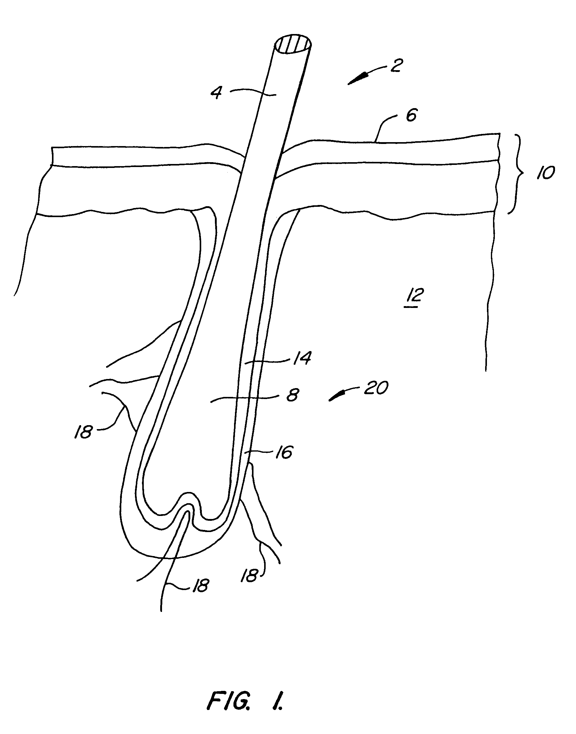 Tissue treatment device and method