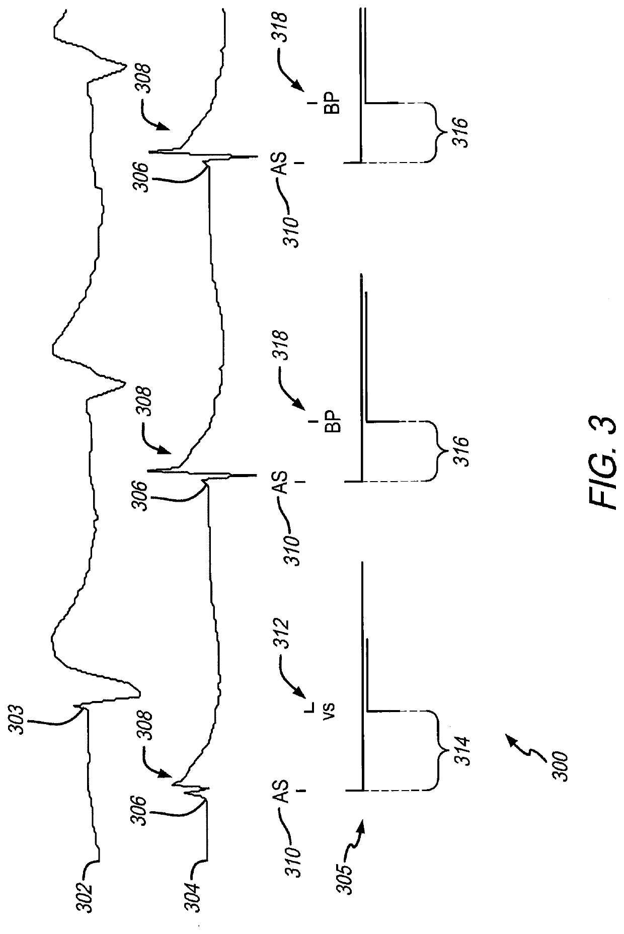 Method and system for adaptive bi-ventricular fusion pacing