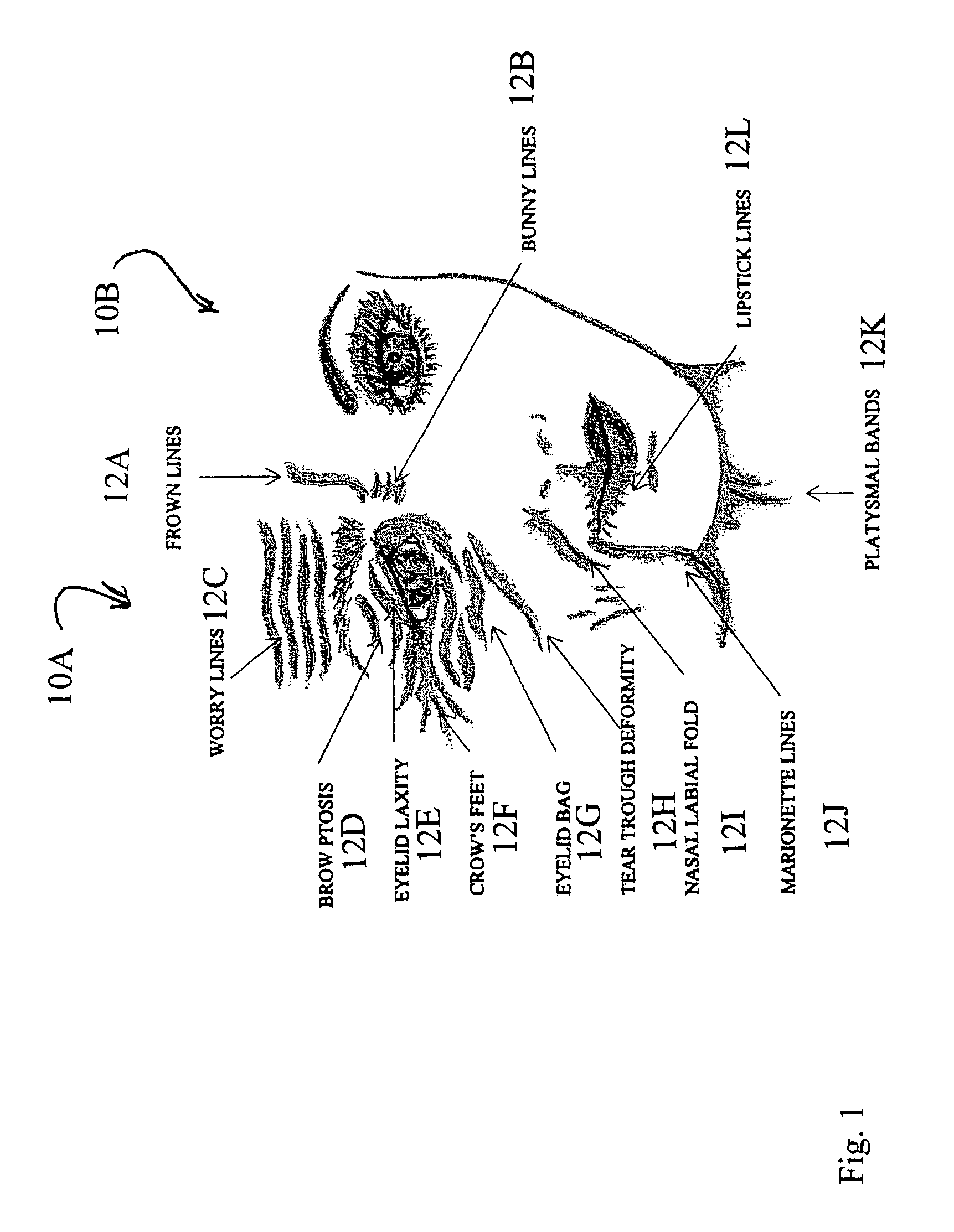 Method for non-surgical facial rejuvenation