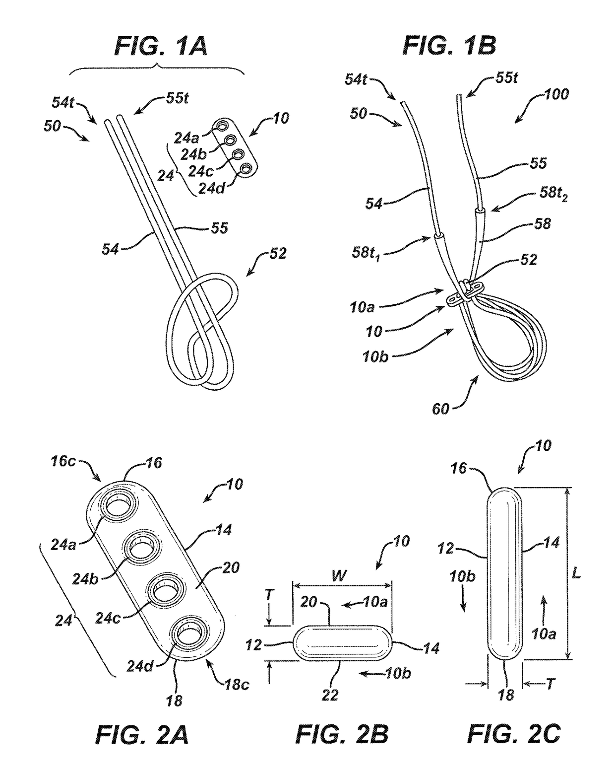 Implant having adjustable filament coils