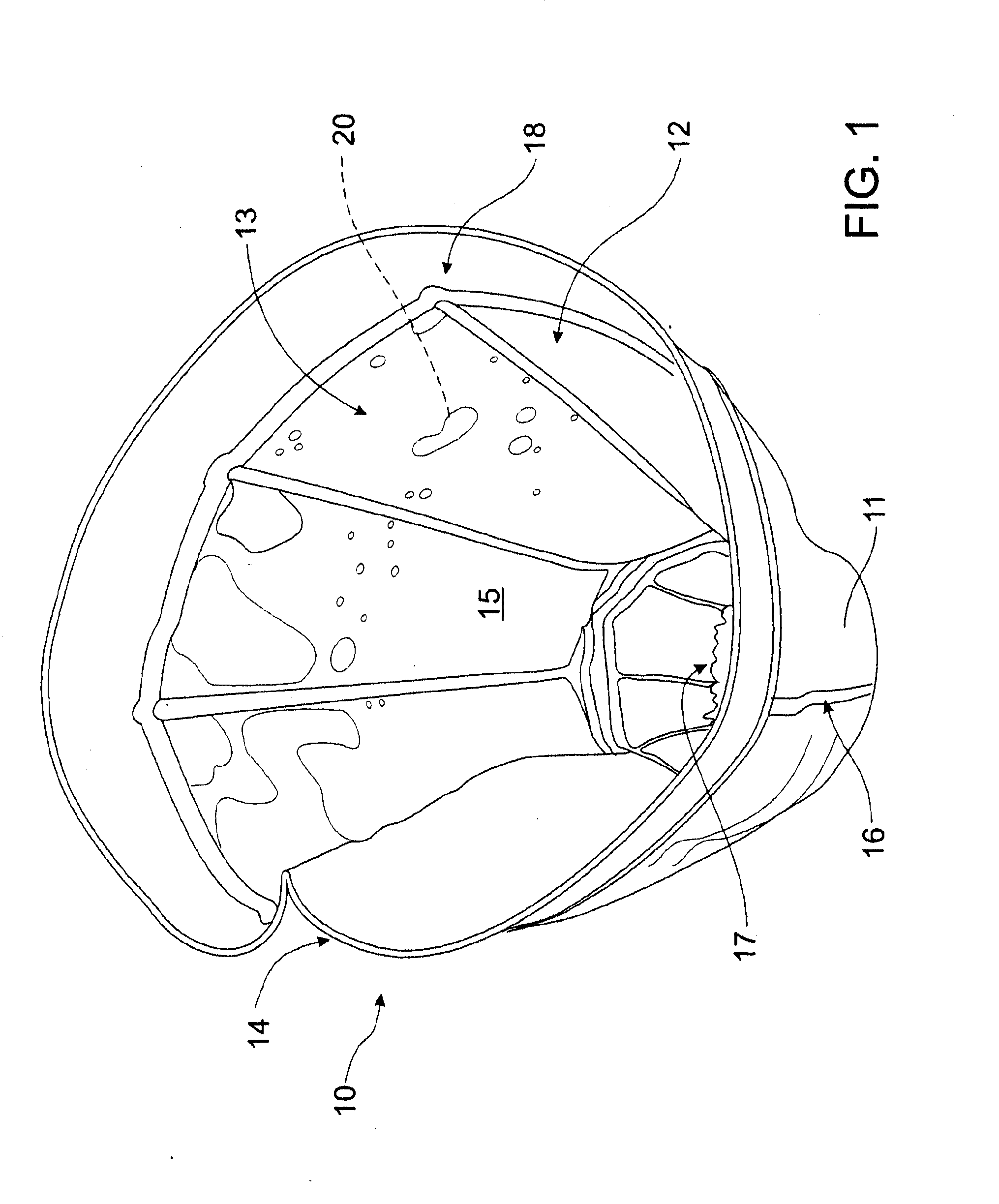 Method of, and apparatus for, making frozen beverage, ice cream and other frozen confections