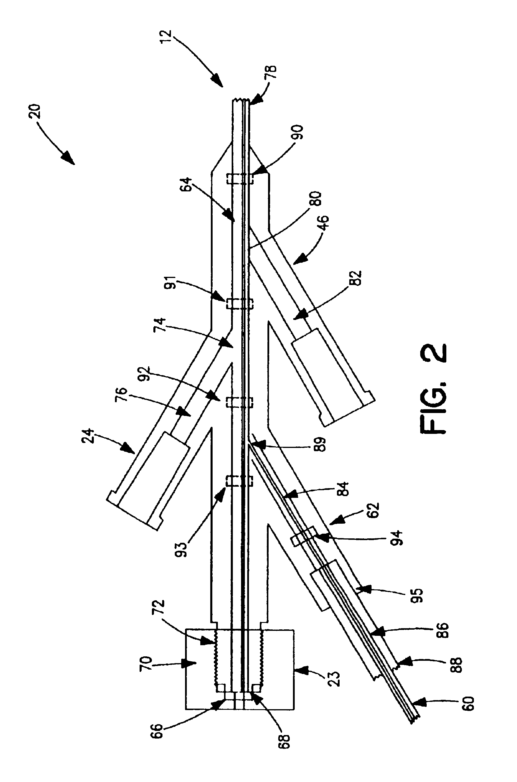 Thrombectomy and tissue removal method