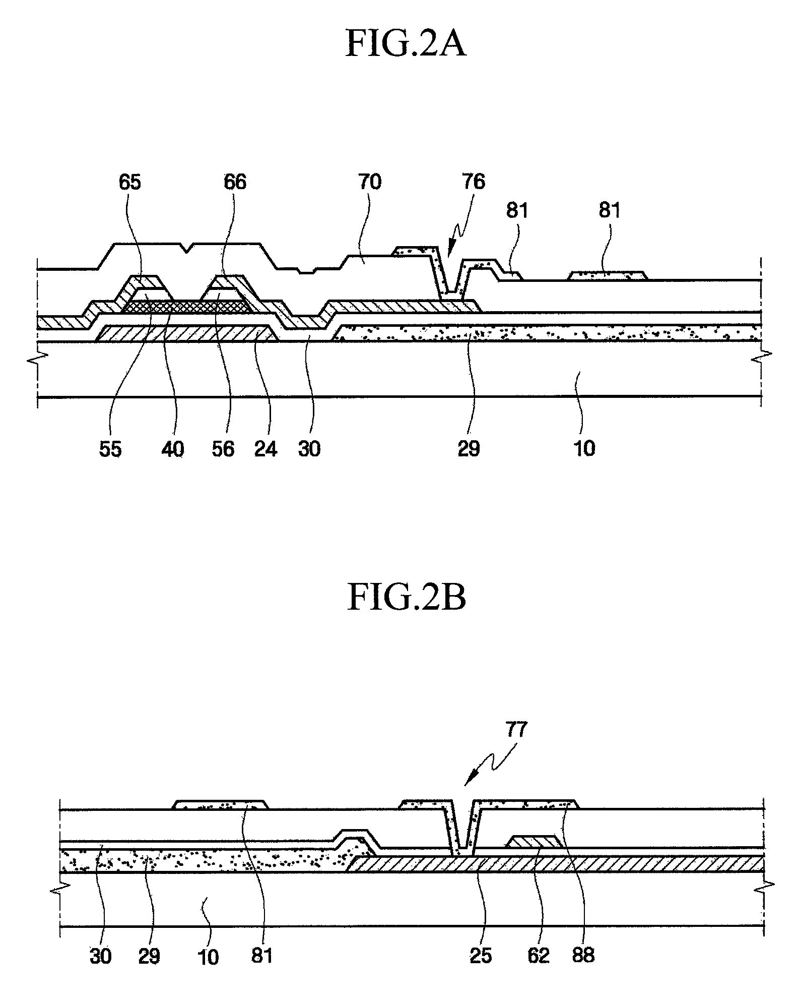 Liquid crystal display