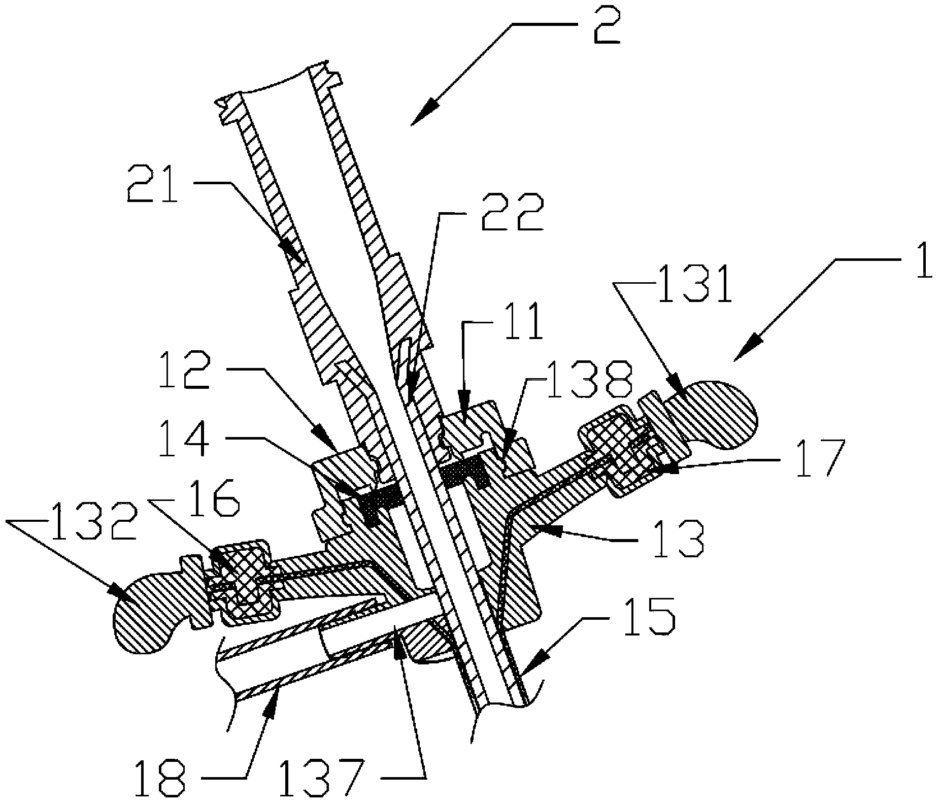 Novel vessel sheath