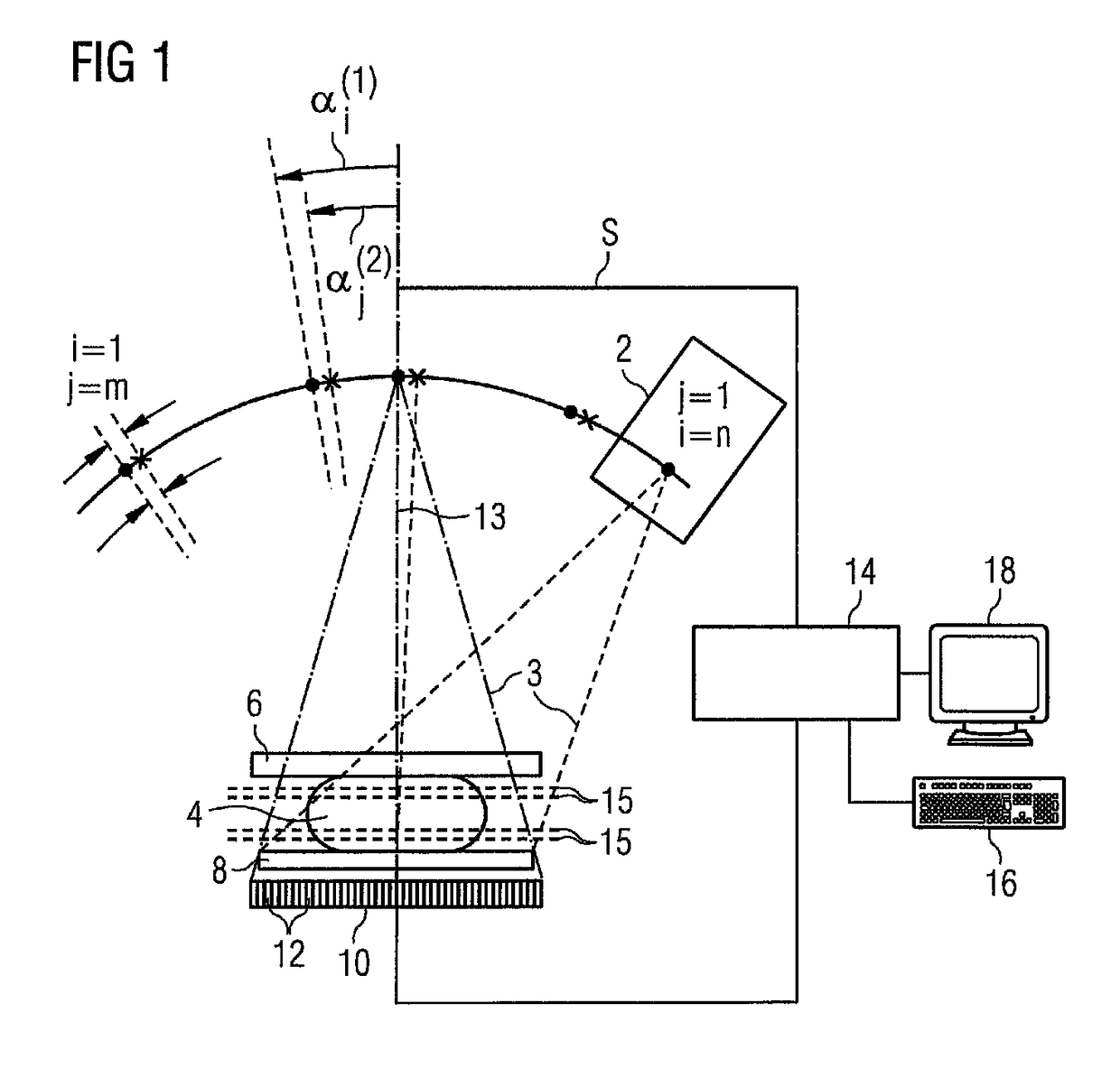 Mammography method and apparatus to generate an X-ray tomosynthesis image of a breast of a patient