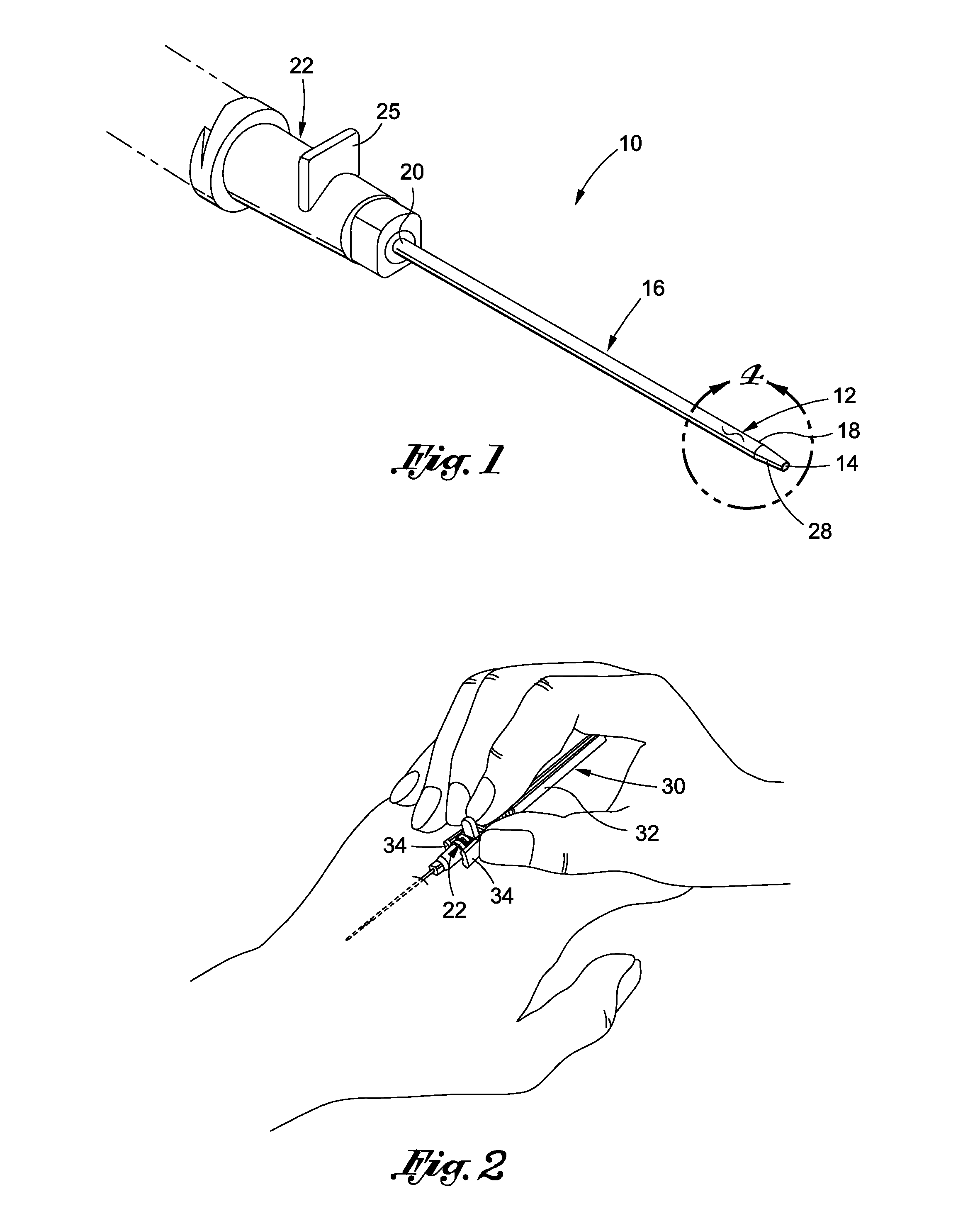 Over the needle catheter with curvilinear slit