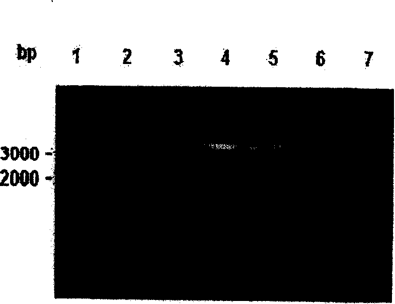 Method for coustructing shRNA expression carrier for inhibiting N-acetylglucosamine transferase V and its use