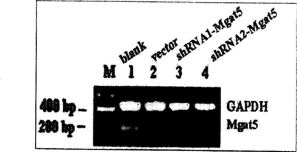 Method for coustructing shRNA expression carrier for inhibiting N-acetylglucosamine transferase V and its use