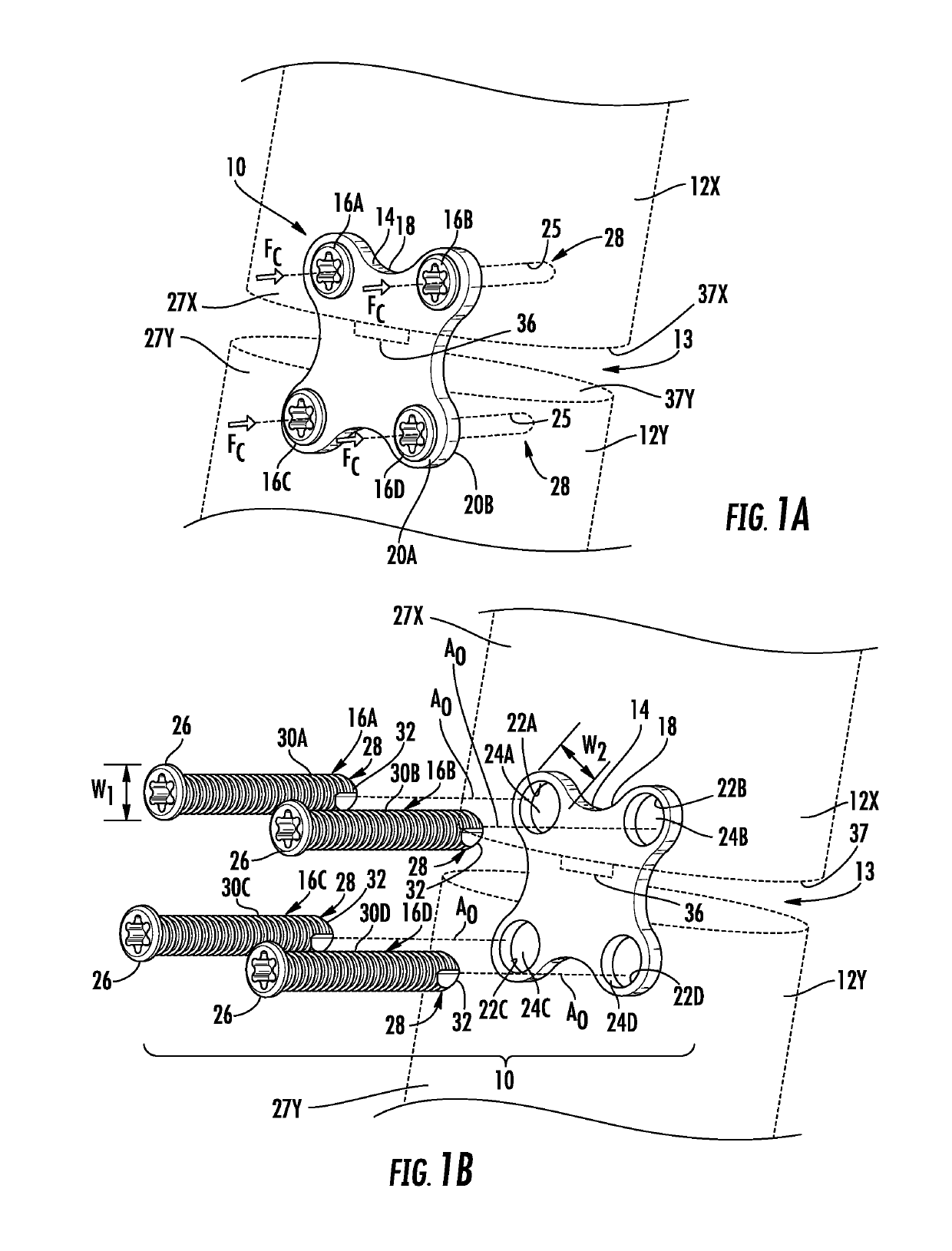 Anterior cervical plates for spinal surgery employing anchor backout prevention devices, and related systems and methods