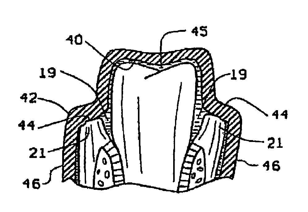 Periodontal medicament delivery tray