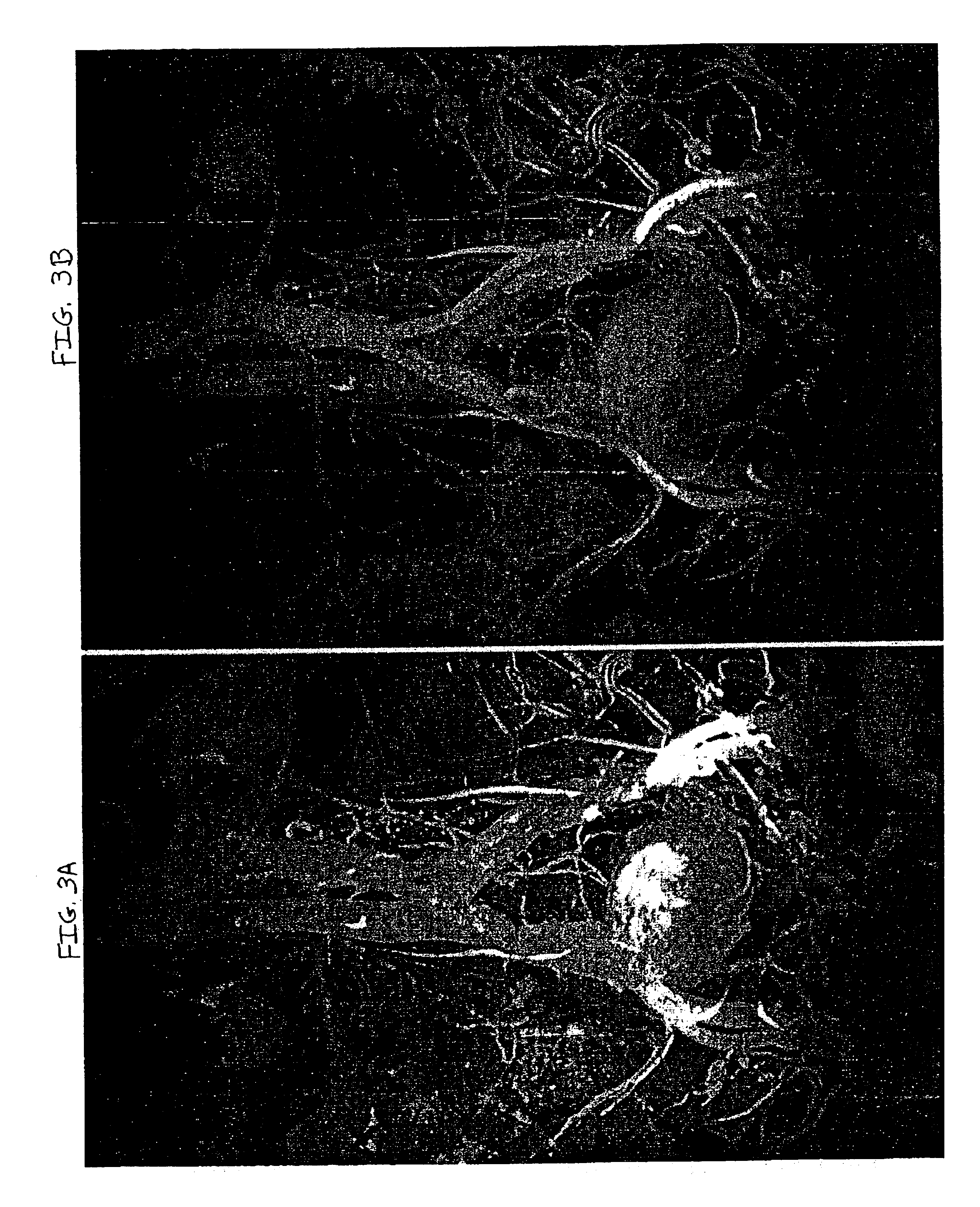 Magnetic resonance angiography data