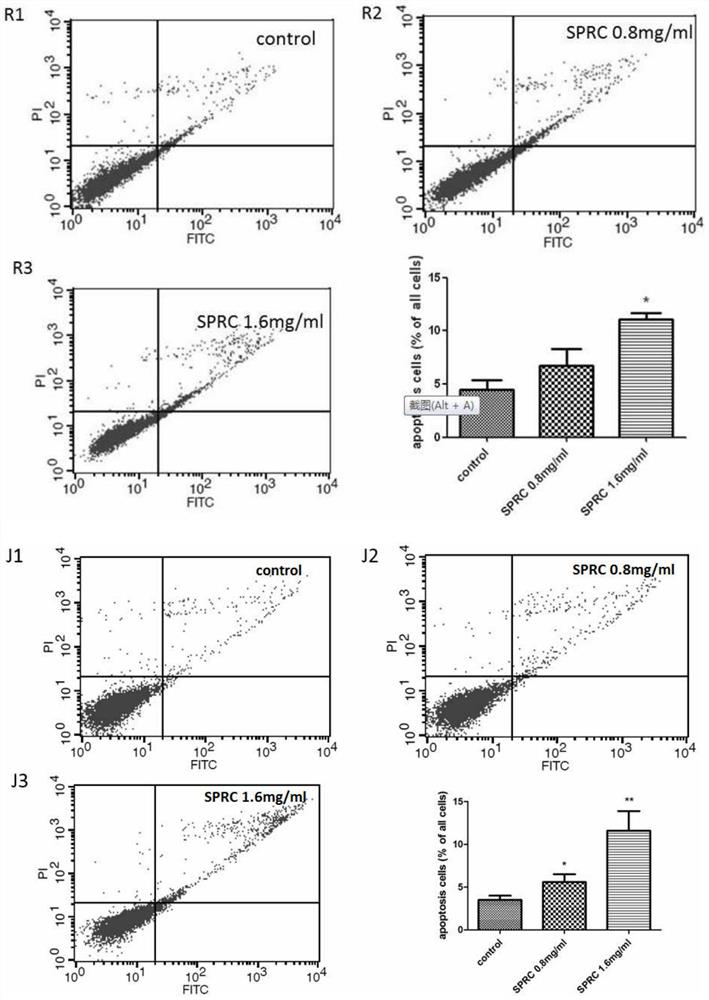 Use of propargyl cysteine ​​in the preparation of drugs for treating hematological systemic tumors