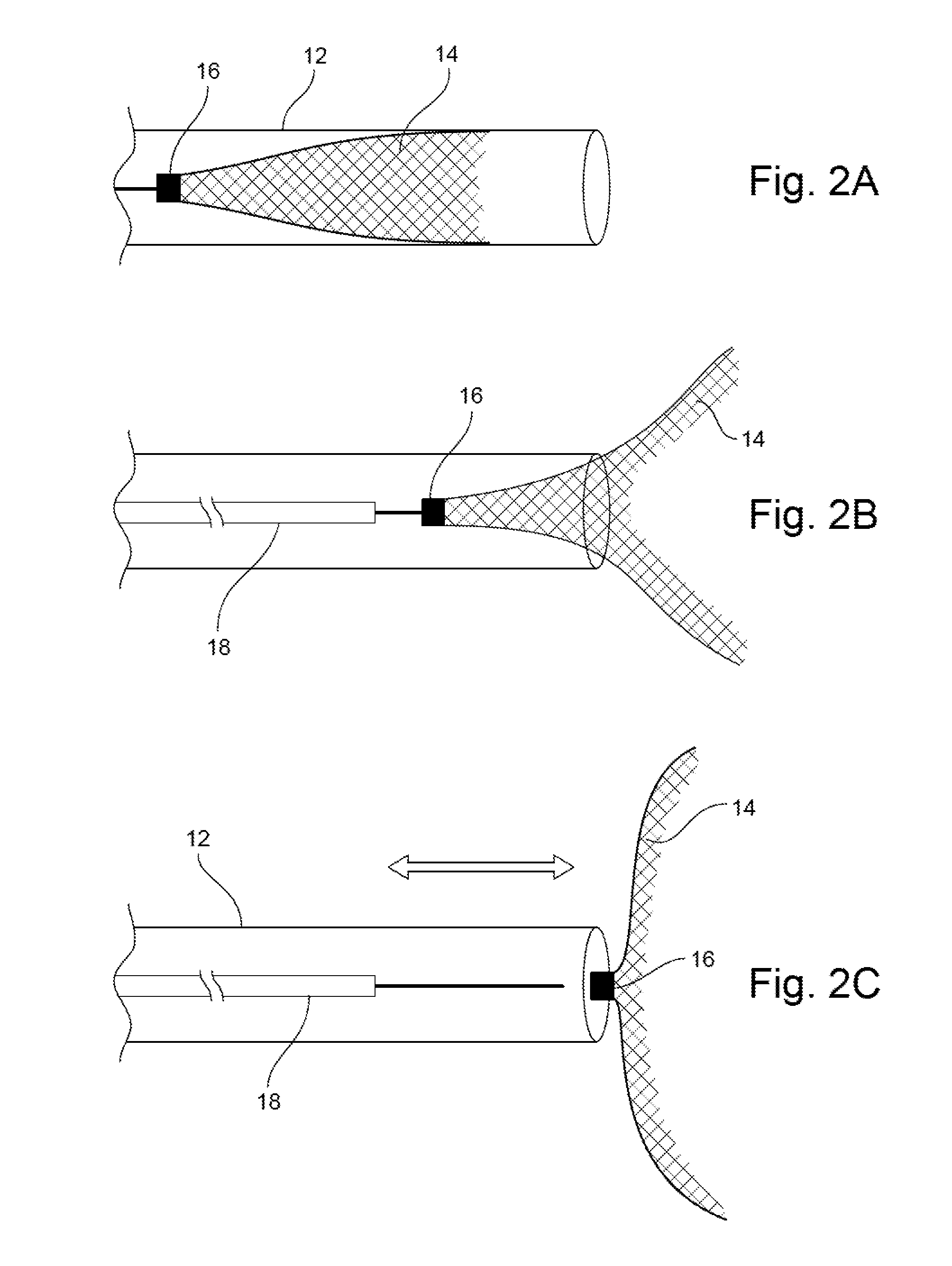 Occlusion Device