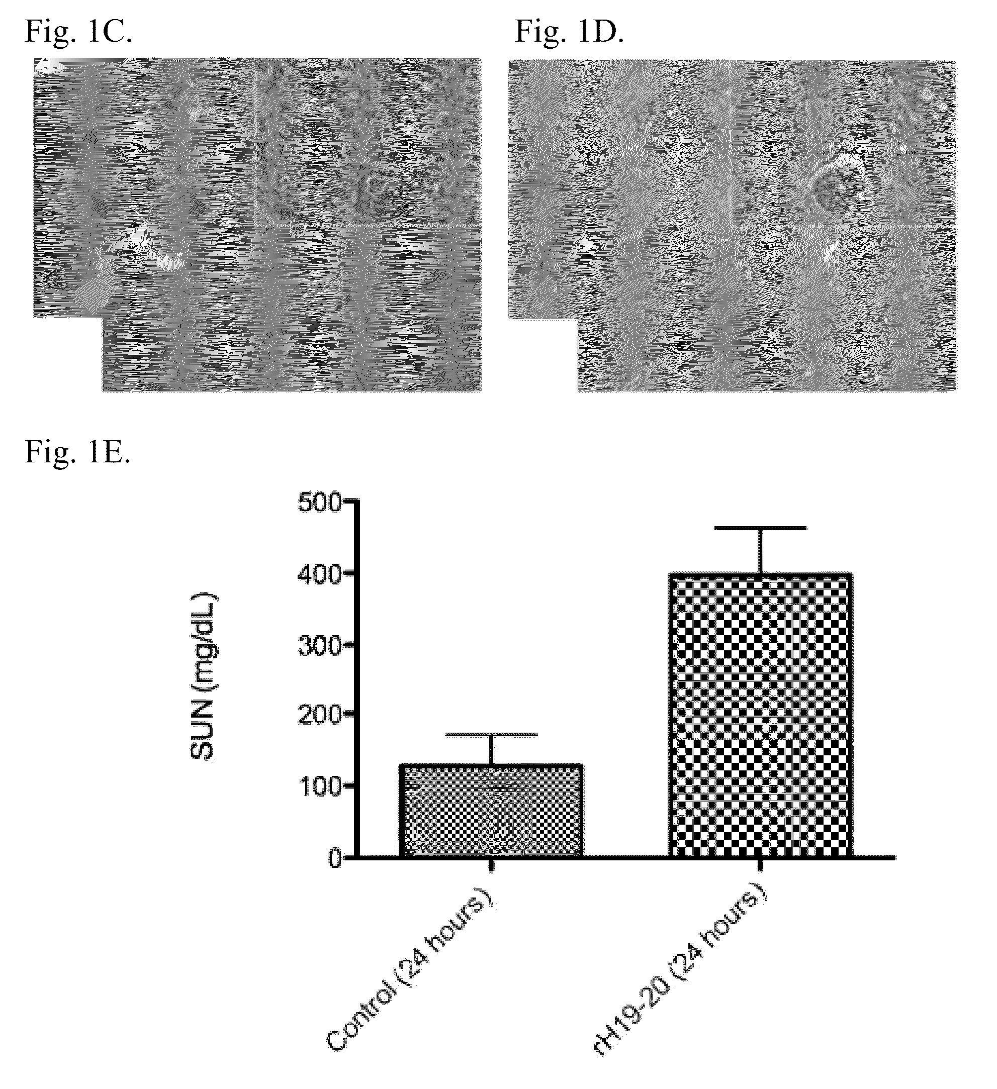 Modulating the alternative complement pathway